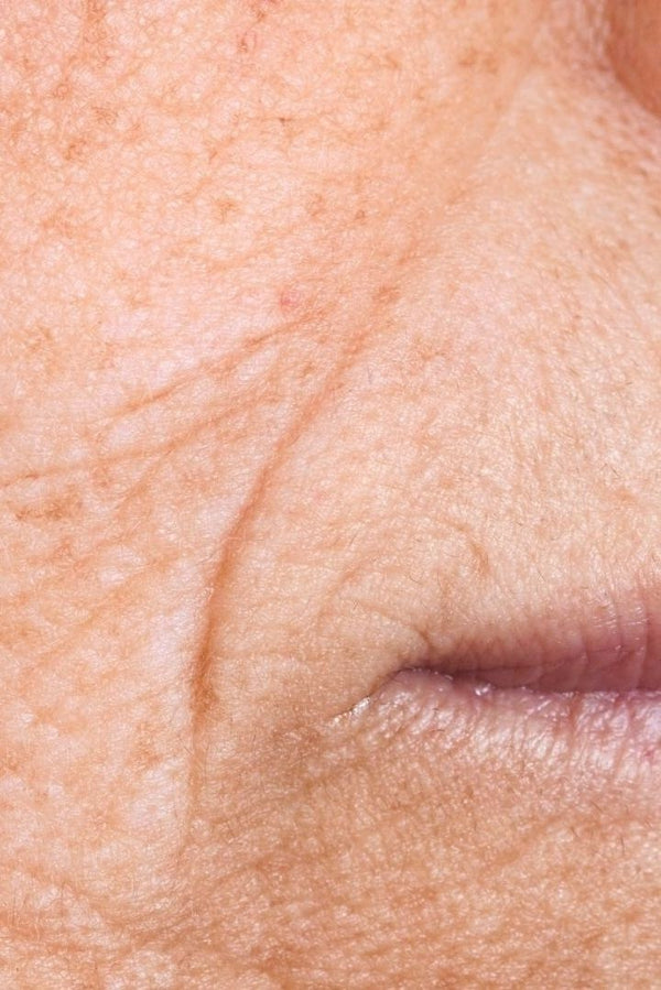 Anti-Aging