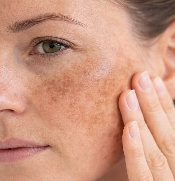 Dark Spots
