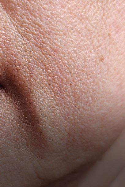 Mature Skin